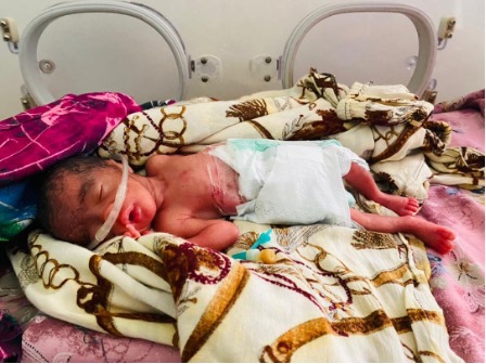 Image of a newborn in the NICU at Edna Adan Hospital in Somaliland