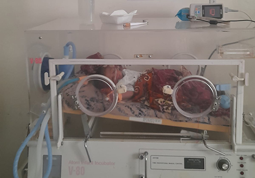 Photo of a baby in a nicu at the Edna Adan Hospital in Somaliland